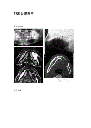 【口腔醫(yī)學(xué)總結(jié)】口腔影像圖片