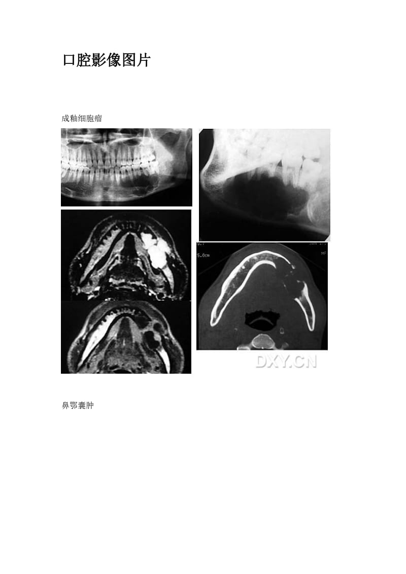 【口腔医学总结】口腔影像图片_第1页