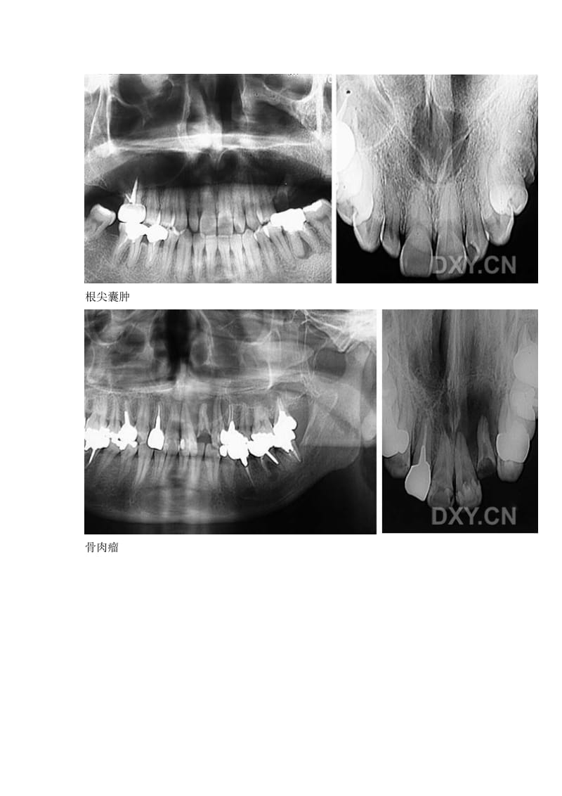 【口腔医学总结】口腔影像图片_第2页