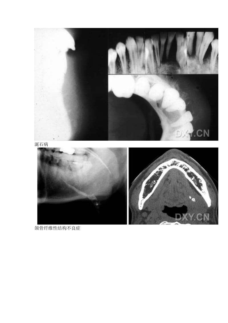 【口腔医学总结】口腔影像图片_第3页