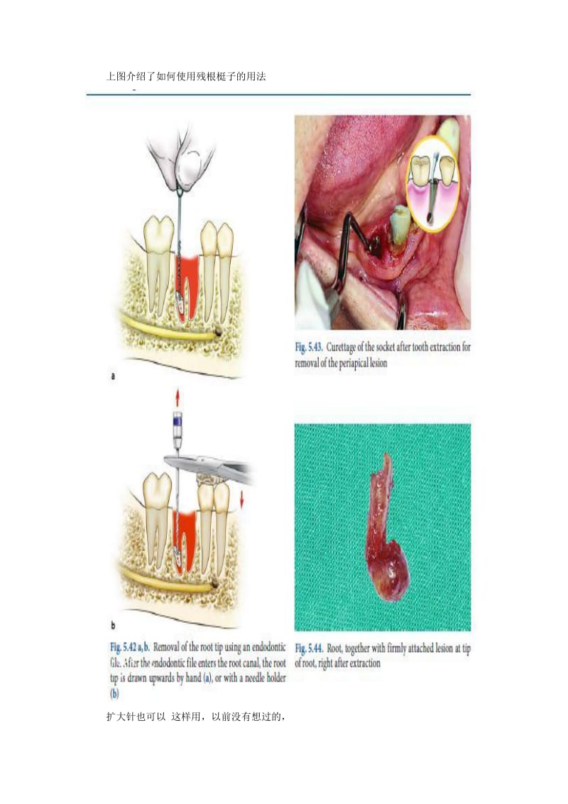 【口腔医学总结】口腔外科手术的经典集锦~范鑫整理_第3页