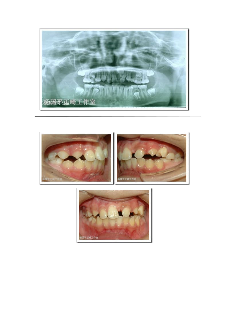 【口腔医学总结】警惕正畸治疗中的陷阱（一）_第3页