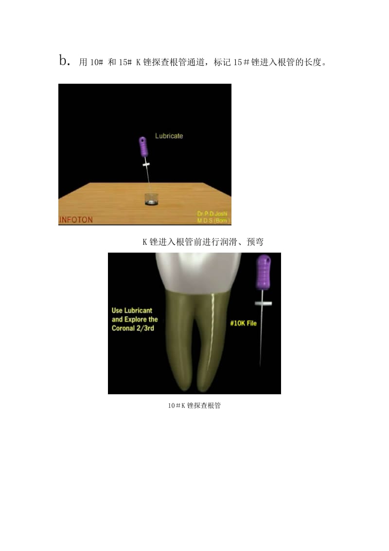 【口腔医学总结】Protaper操作方法_第2页