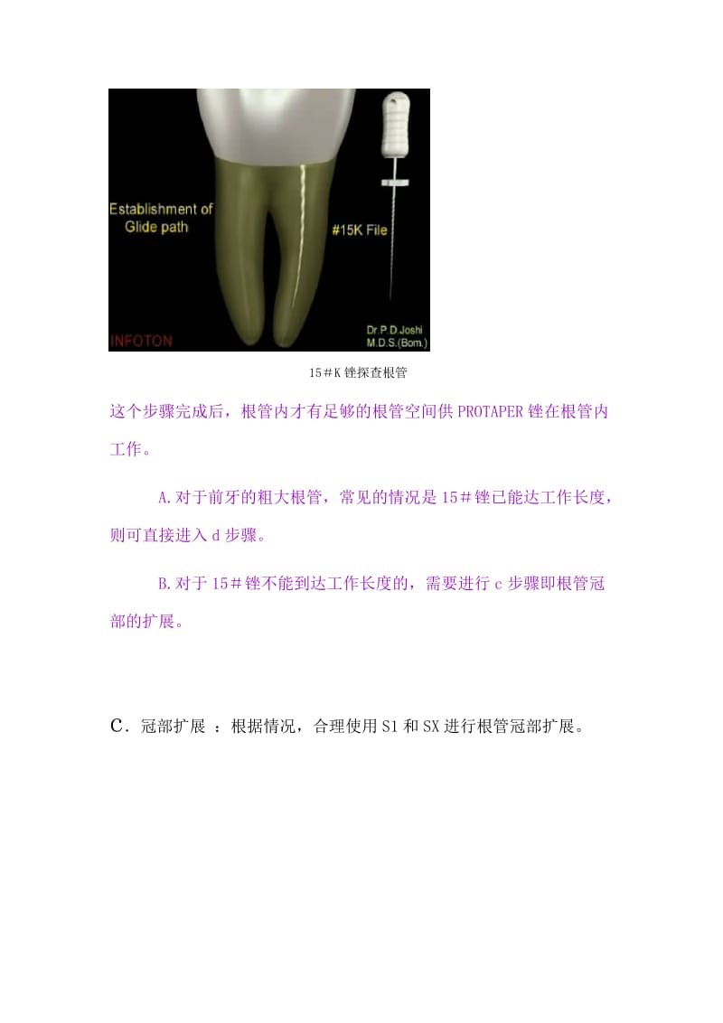 【口腔医学总结】Protaper操作方法_第3页