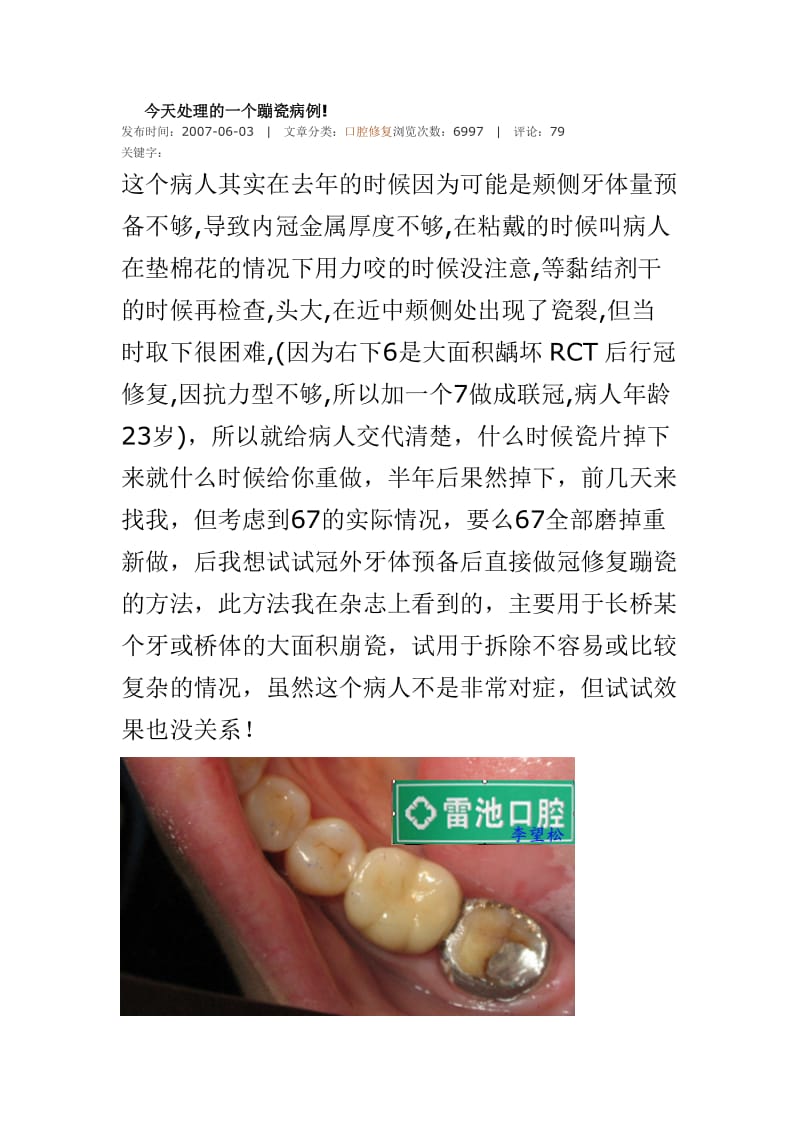 【口腔医学总结】今天处理的一个蹦瓷病例!_第1页