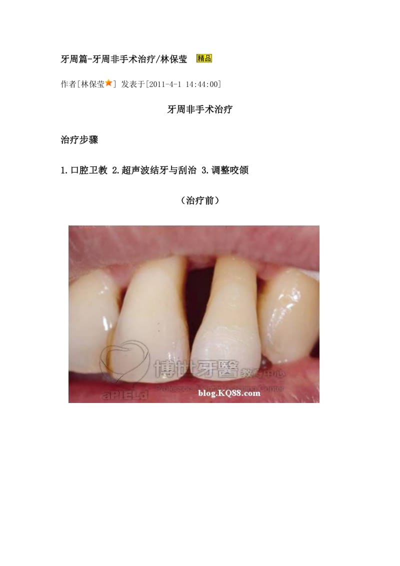【口腔医学总结】牙周篇-牙周非手术治疗_第1页
