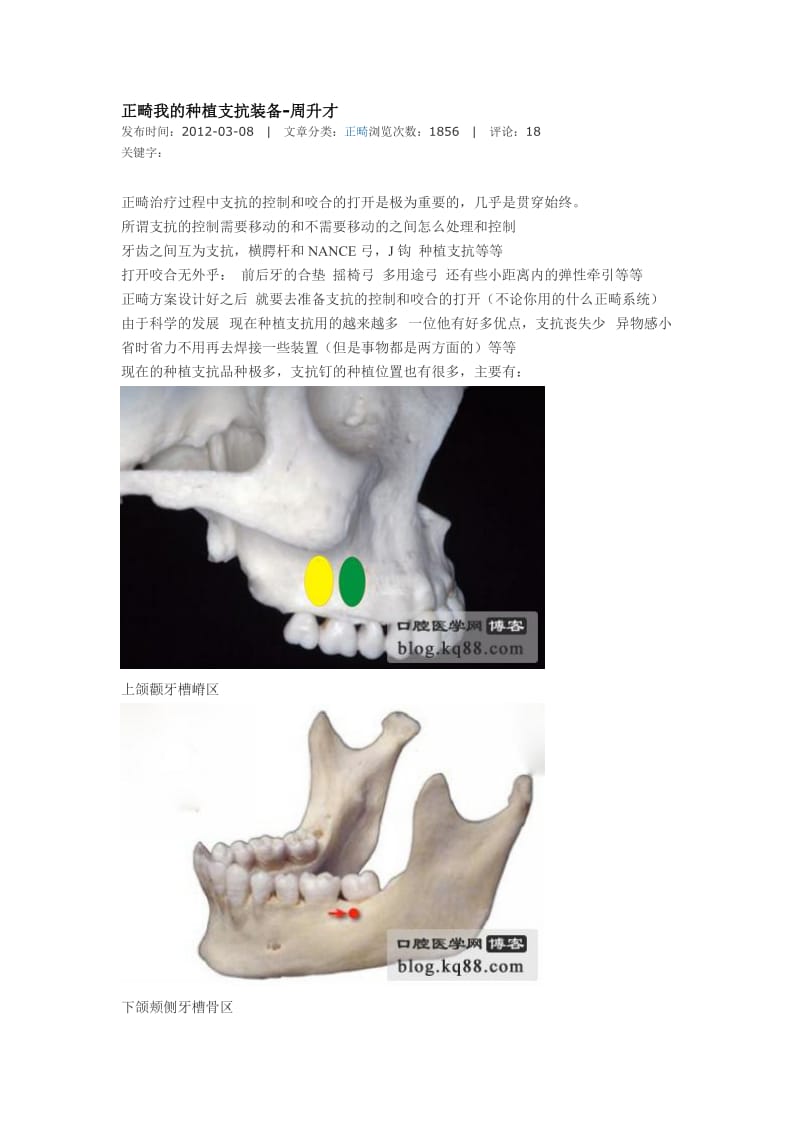 【口腔医学总结】正畸我的种植支抗装备-周升才_第1页