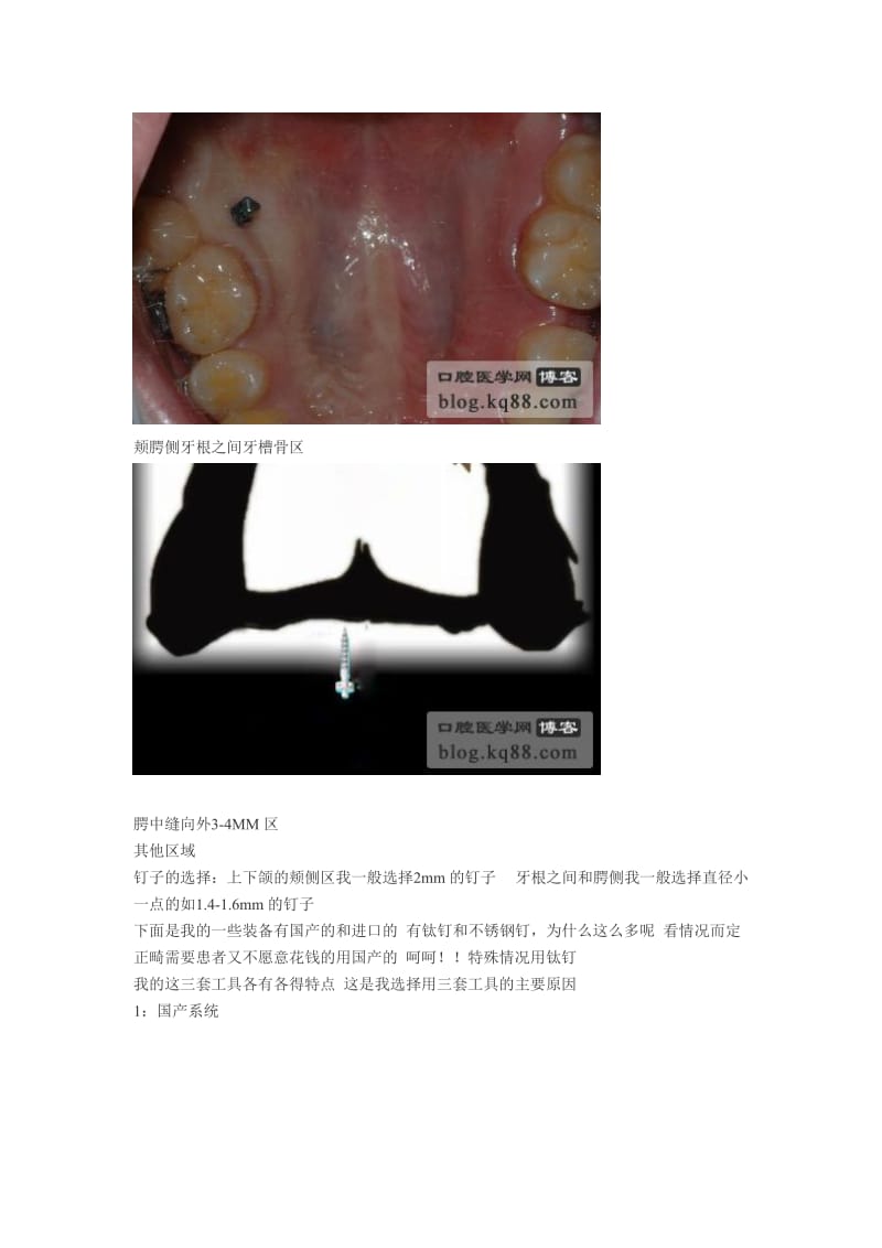 【口腔医学总结】正畸我的种植支抗装备-周升才_第2页