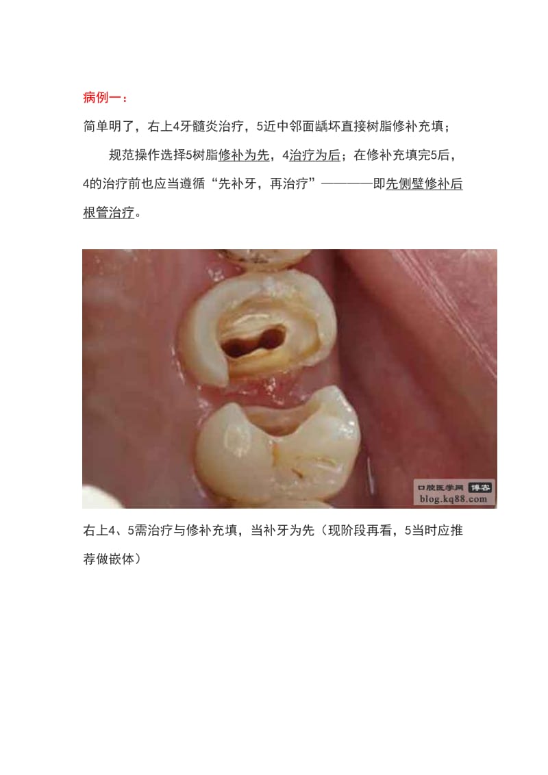 【口腔医学总结】从口内到修复能者能为——秦菲（安徽小牙）_第3页