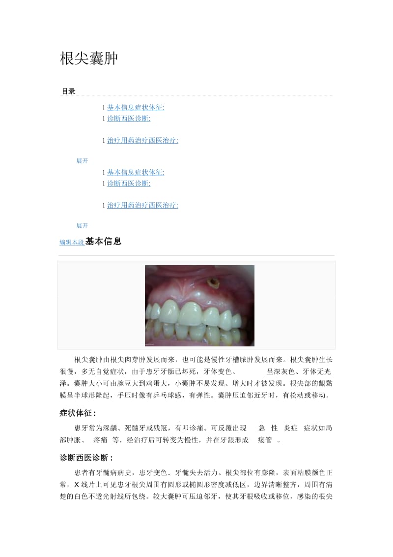 【口腔医学总结】根尖囊肿_第1页