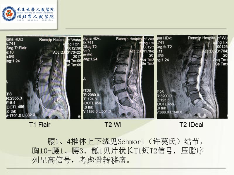 MRI诊断入门病例(二).ppt_第2页