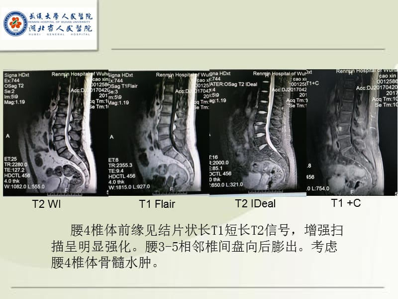 MRI诊断入门病例(二).ppt_第3页