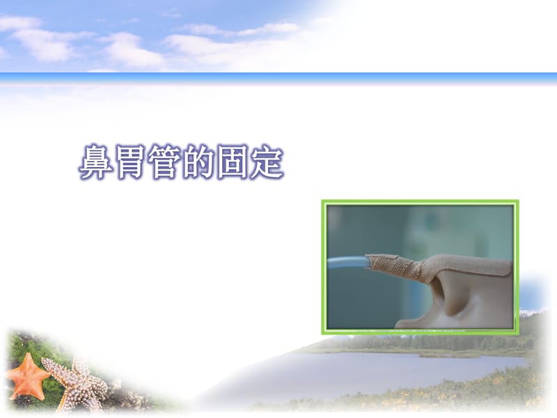 《各种导管的固定》PPT课件.ppt_第2页