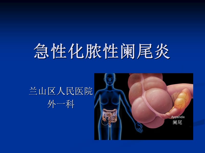 急性化脓性阑尾炎.ppt_第1页