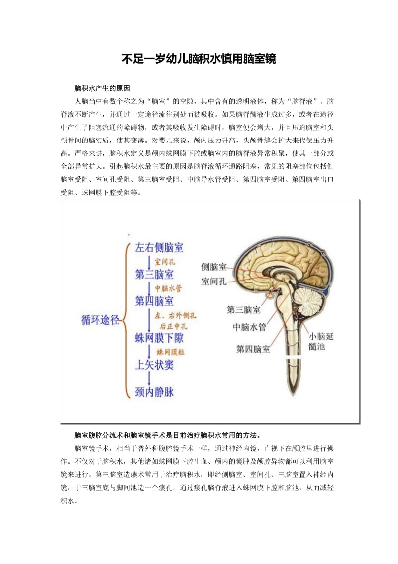 不足一岁幼儿脑积水慎用脑室镜.doc_第1页