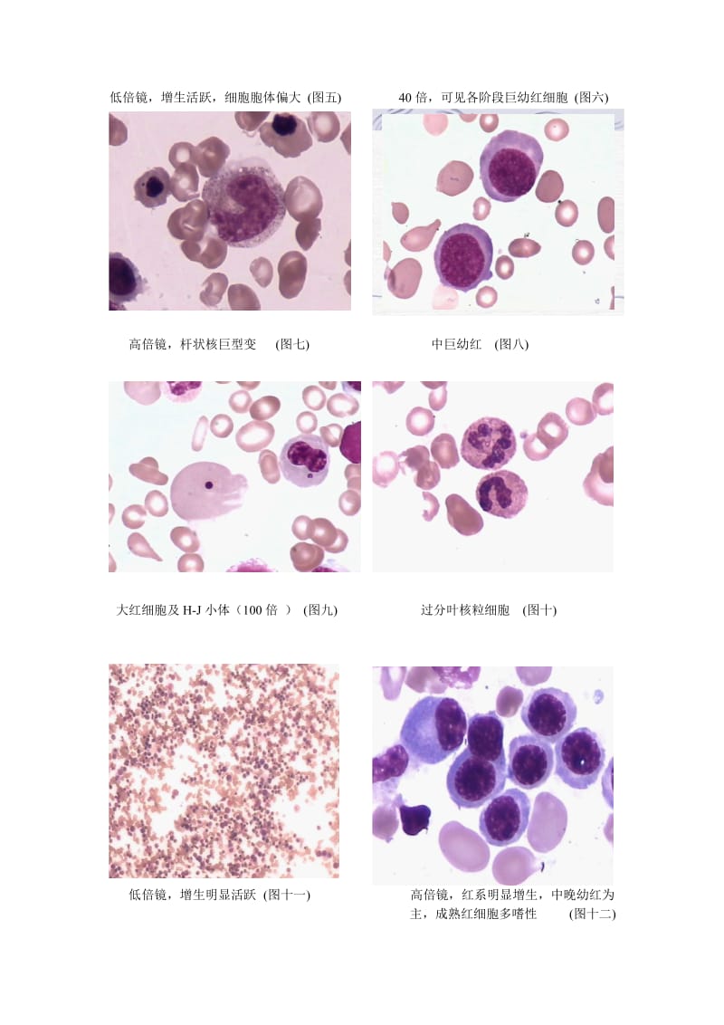 血细胞形态图片.doc_第2页