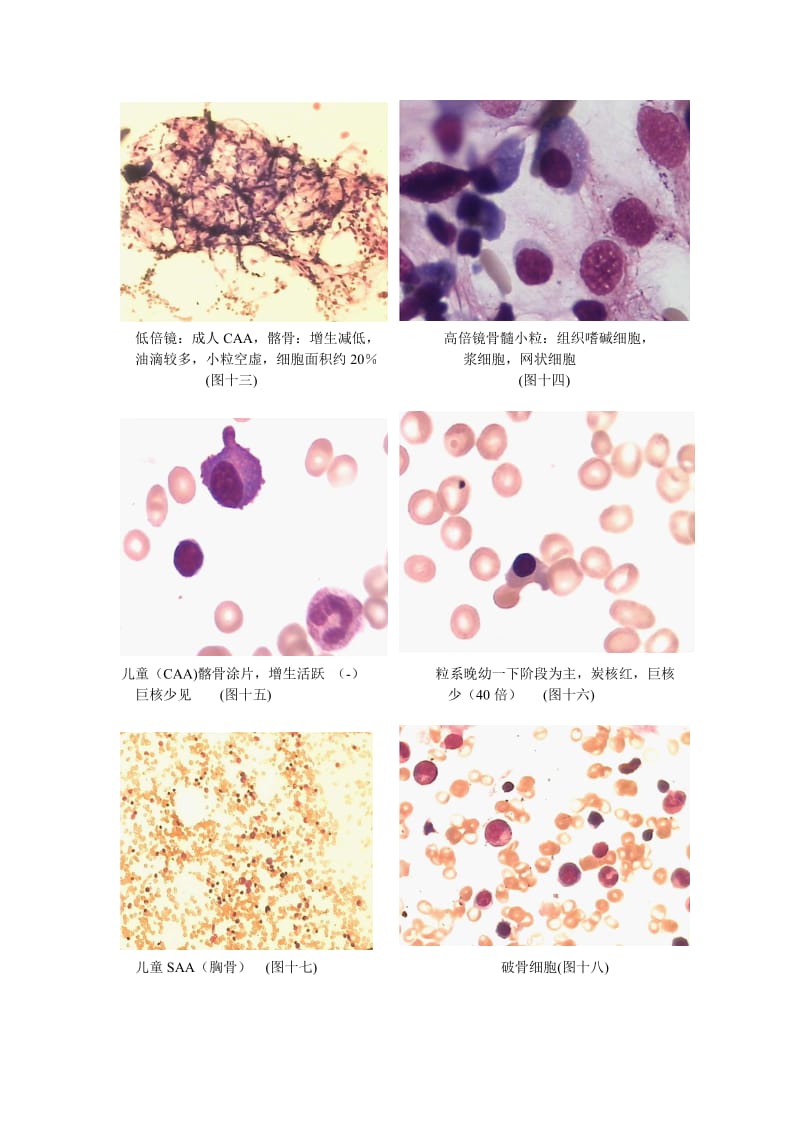 血细胞形态图片.doc_第3页