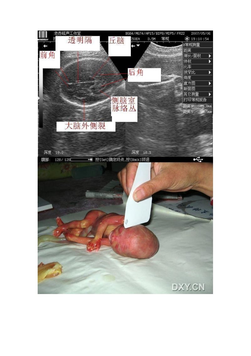 胎儿超声标准切面.doc_第2页
