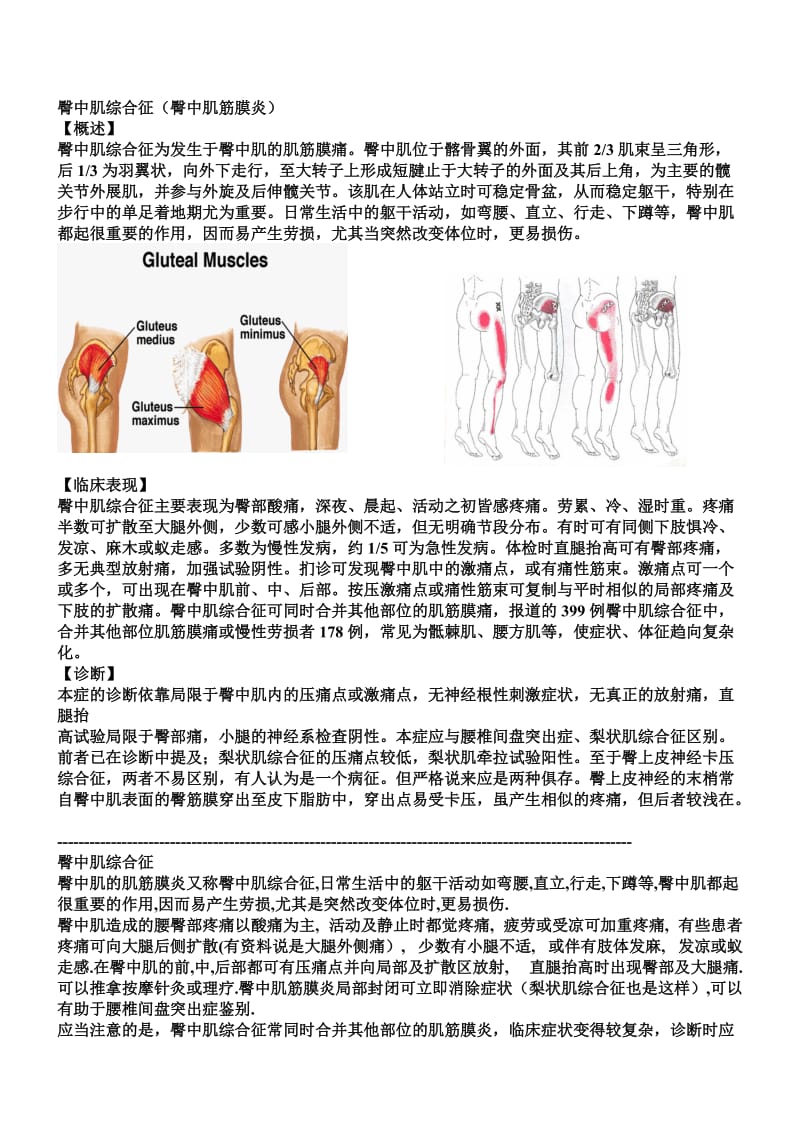 臀中肌综合征(臀中肌筋膜炎).doc_第1页