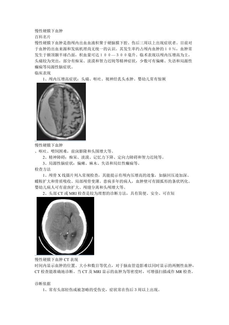 慢性硬膜下血肿.doc_第1页