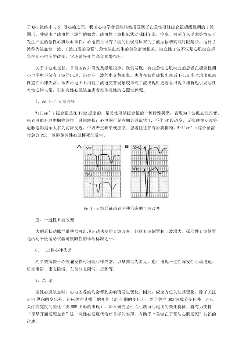 心肌缺血心电图分析.doc_第3页