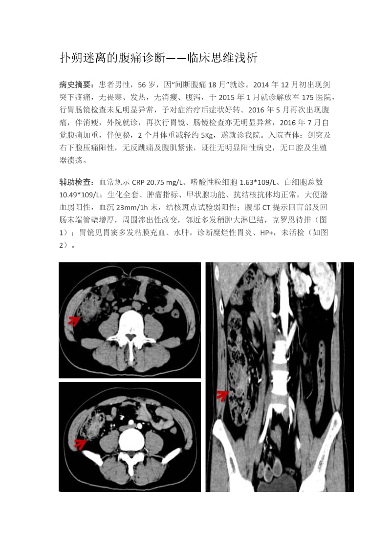 嗜酸性粒细胞胃肠炎.doc_第1页