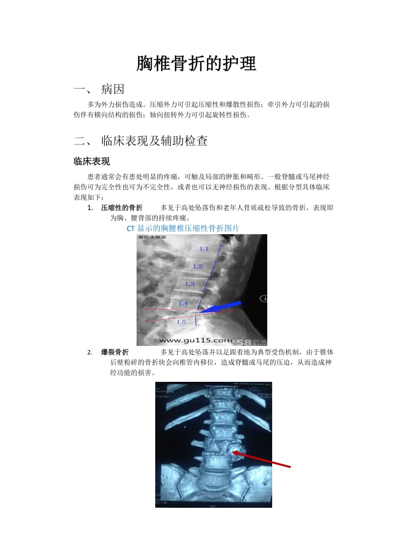 胸椎骨折的护理.doc_第1页