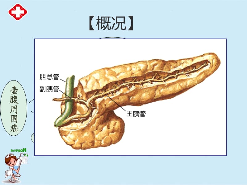 胰腺癌病人的护理ppt (2).ppt_第3页