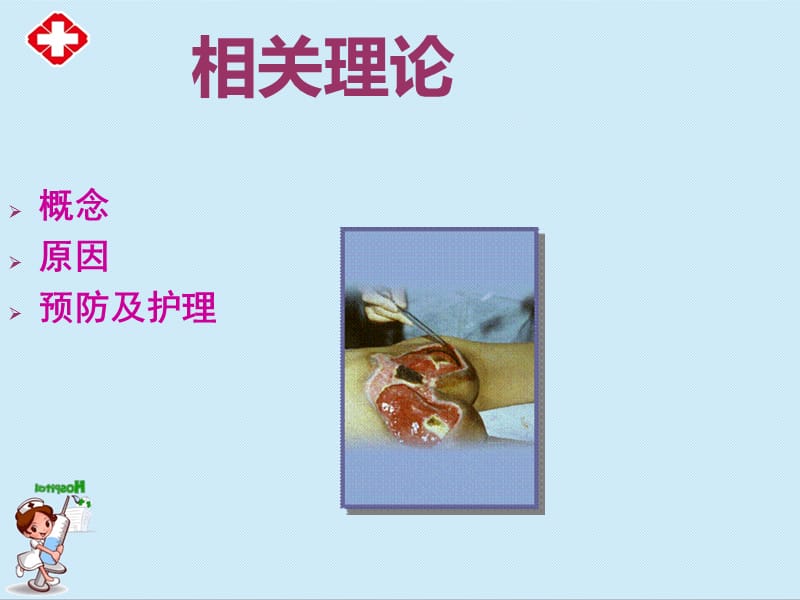 压疮的预防及护理ppt.ppt_第2页