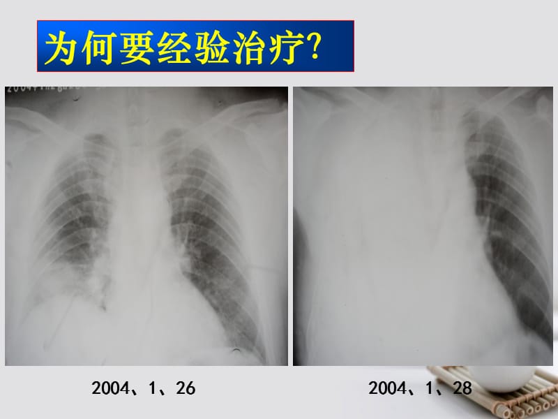 《社区获得性肺炎的经验治疗》ppt.ppt_第3页