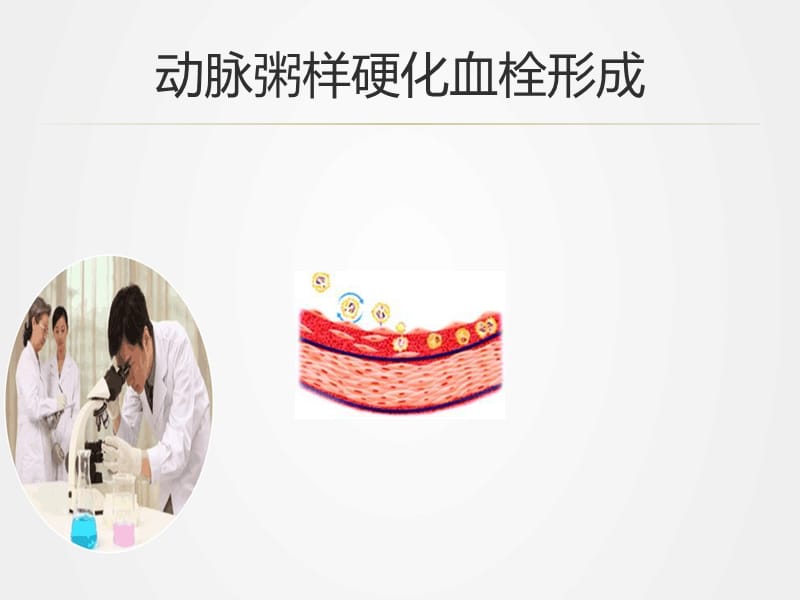 《冠心病健康手册》ppt.ppt_第3页