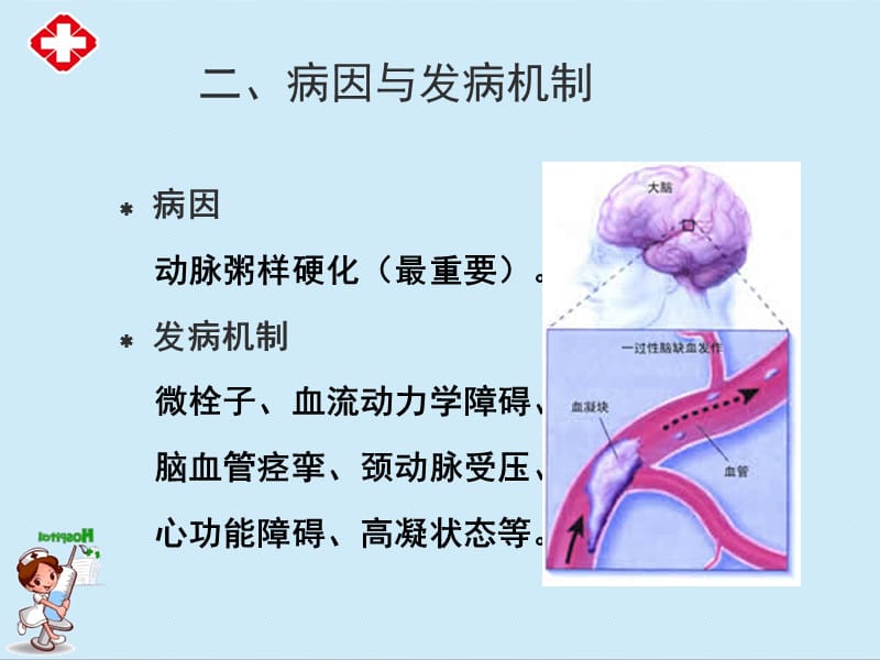 短暂性脑缺血发作ppt.ppt_第3页