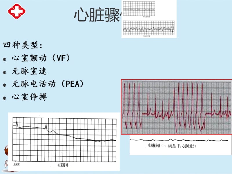 电复律与除颤临床培训ppt.ppt_第2页