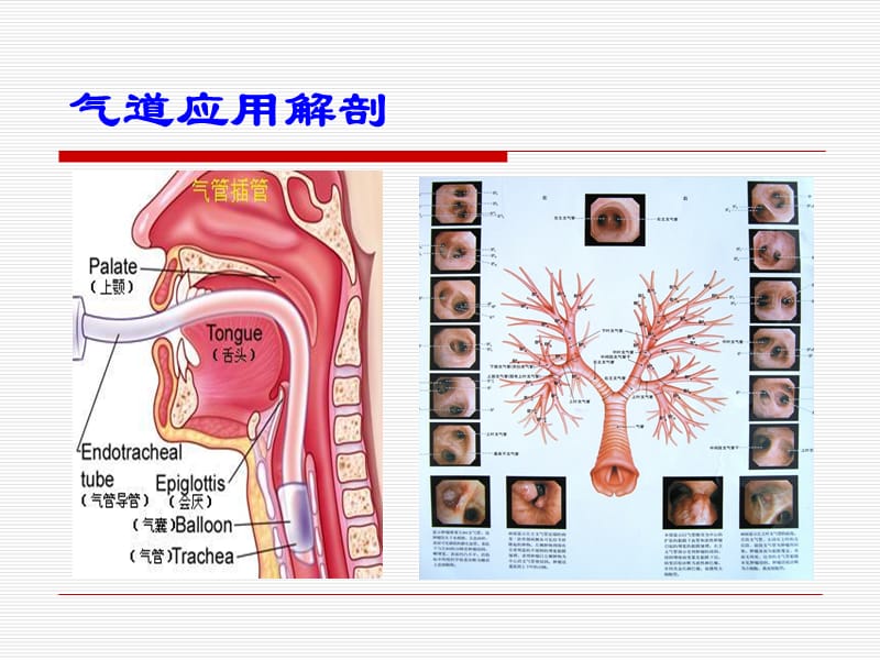 《人工气道护理》PPT课件.ppt_第3页