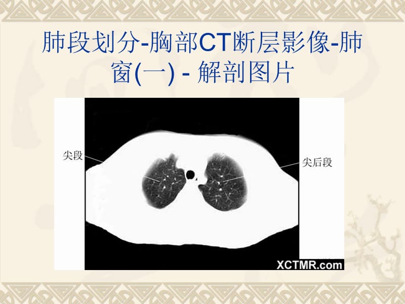 全身CT断层解剖详细实用图解.ppt_第3页