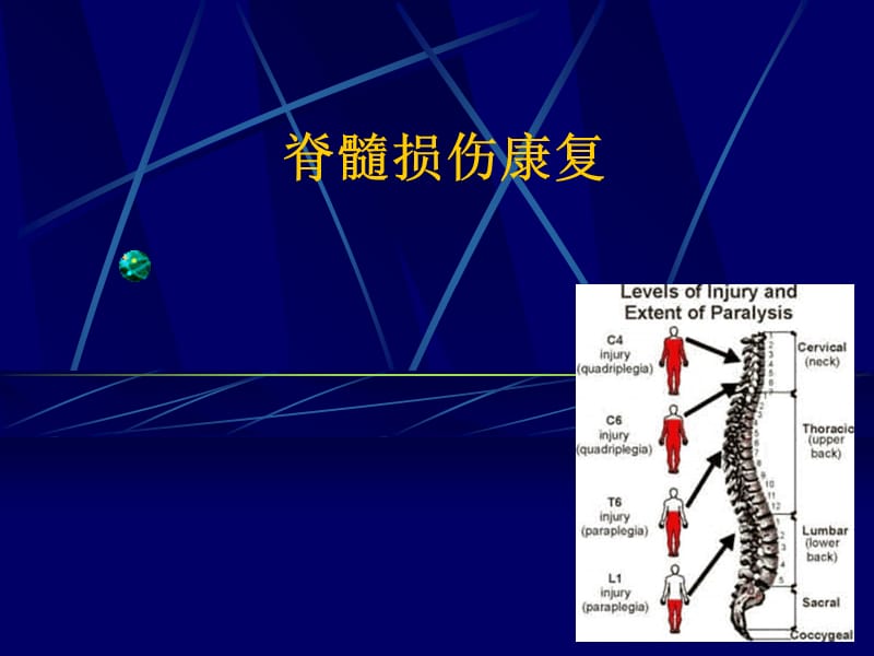 脊髓损伤康复-PPT课件.ppt_第1页
