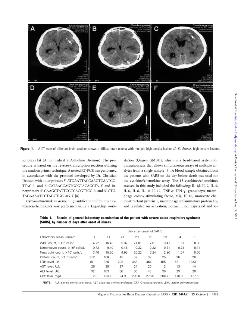 【病毒外文文献】2005 Detection of Severe Acute Respiratory Syndrome Coronavirus in the Brain_ Potential Role of the Chemokine Mig in Pat_第3页