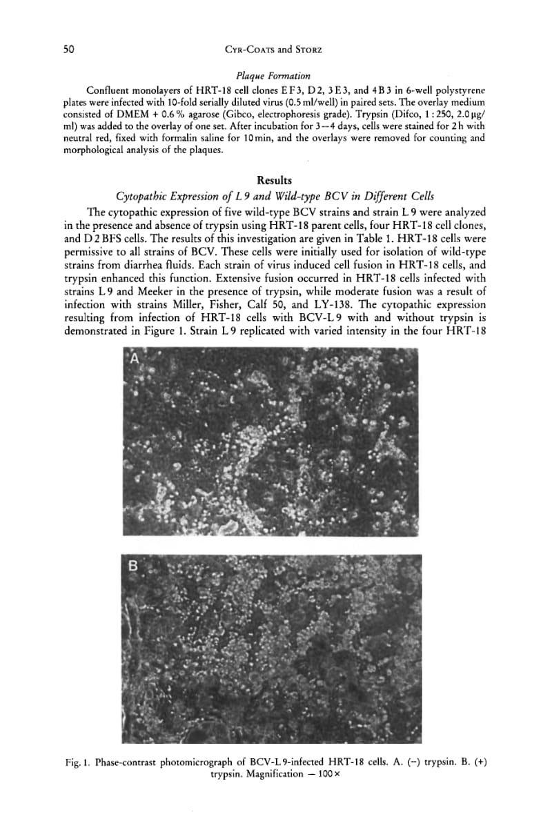 【病毒外文文献】1988 Bovine Coronavirus-Induced Cytopathic Expression and Plaque Formation_ Host Cell and Virus Strain Determine Trypsin_第3页