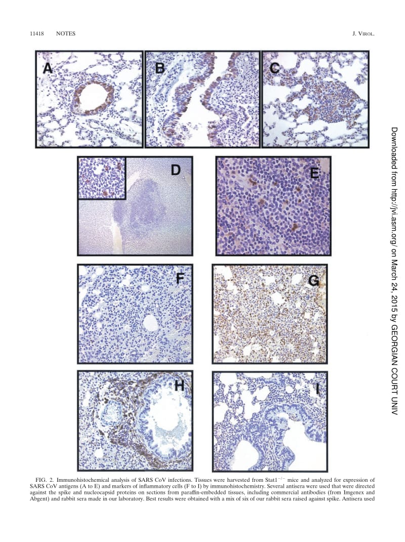 【病毒外文文献】2004 Resolution of Primary Severe Acute Respiratory Syndrome-Associated Coronavirus Infection Requires Stat1_第3页