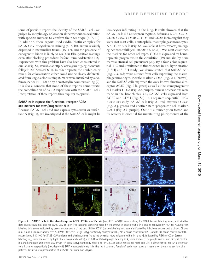 【病毒外文文献】2007 A novel subset of putative stem_progenitor CD34+Oct-4+ cells is the major target for SARS coronavirus in human lung_第3页