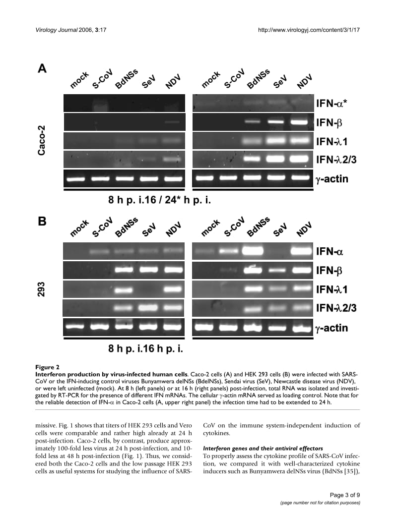 【病毒外文文献】2006 Inhibition of cytokine gene expression and induction of chemokine genes in non-lymphatic cells infected with SARS c_第3页