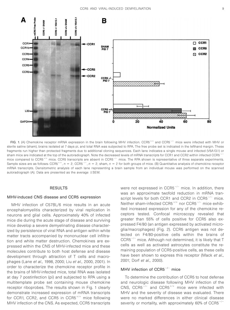 【病毒外文文献】2001 Reduced Macrophage Infiltration and Demyelination in Mice Lacking the Chemokine Receptor CCR5 Following Infection w_第2页