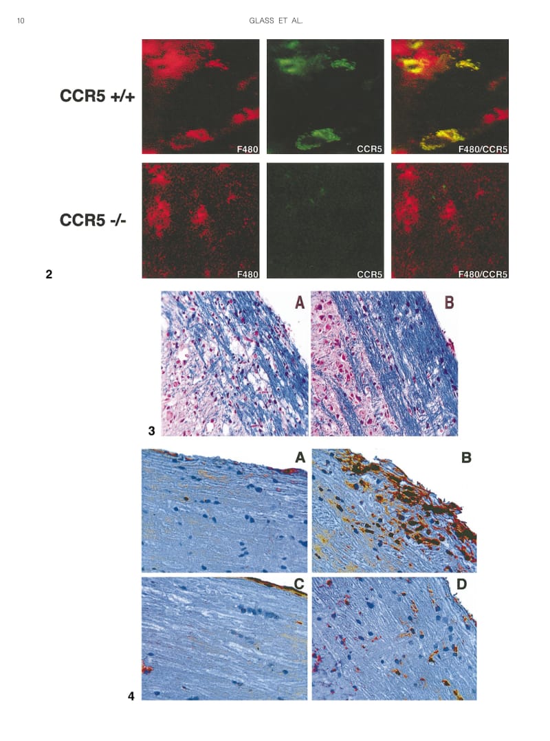 【病毒外文文献】2001 Reduced Macrophage Infiltration and Demyelination in Mice Lacking the Chemokine Receptor CCR5 Following Infection w_第3页