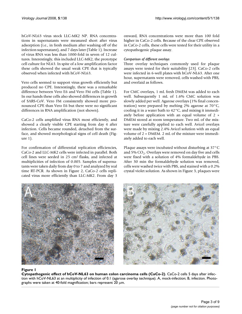 【病毒外文文献】2008 Plaque assay for human coronavirus NL63 using human colon carcinoma cells_第3页