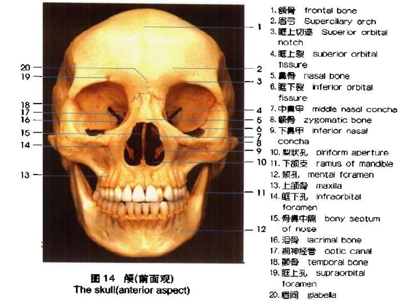 《上颌骨骨折的处理》PPT课件.ppt_第3页