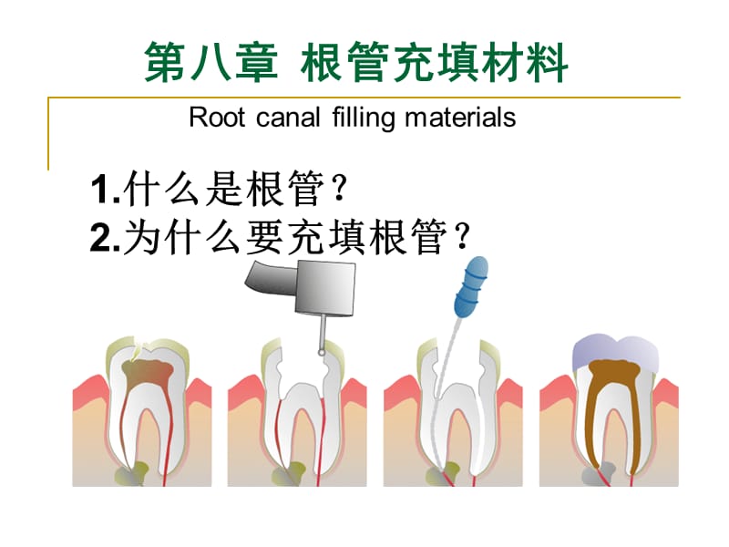 《根管充填材料》PPT课件.ppt_第1页