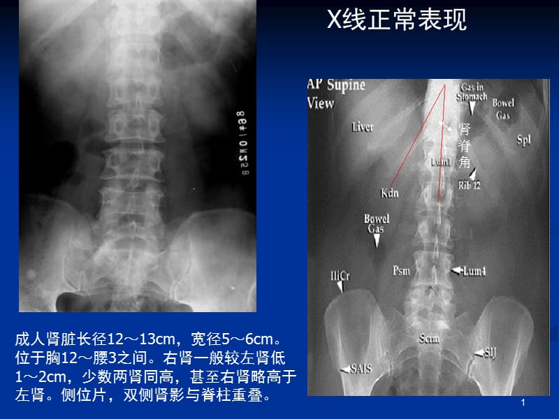 《泌尿系統(tǒng)影像》PPT課件.ppt_第1頁