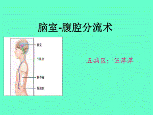 腦室-腹腔分流術