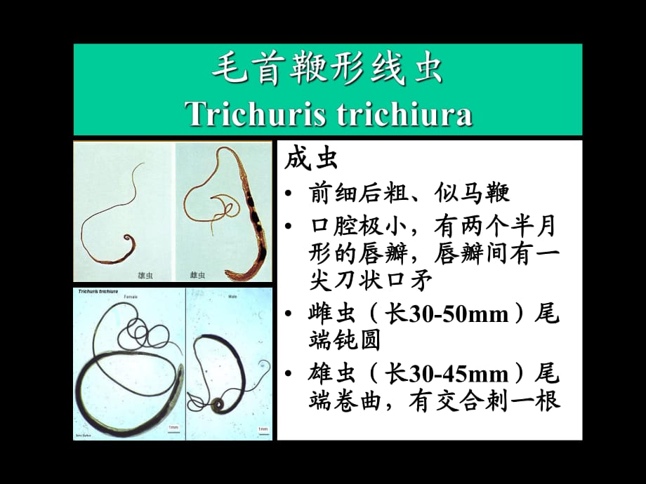 毛首鞭形线虫2Trichuristrichiura_第1页