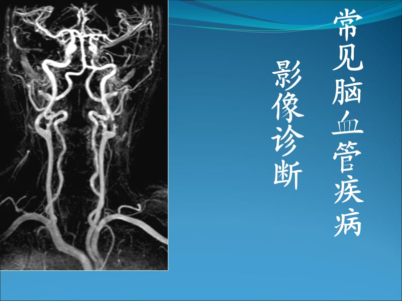 常见脑血管疾病的影像诊断.ppt_第1页